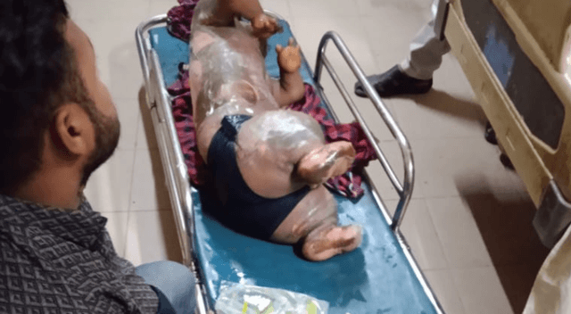 নোয়াখালীতে অটোরিকশার সিলিন্ডার বিস্ফোরণে পাঁচ শিশুসহ আহত-৬