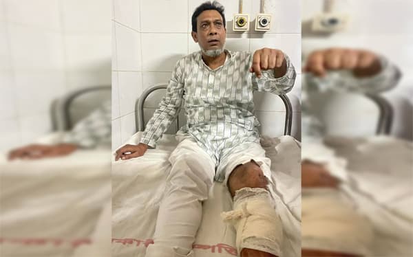 বানারীপাড়ায় কলেজ অধ্যক্ষকে হাতুড়িপেটা!
