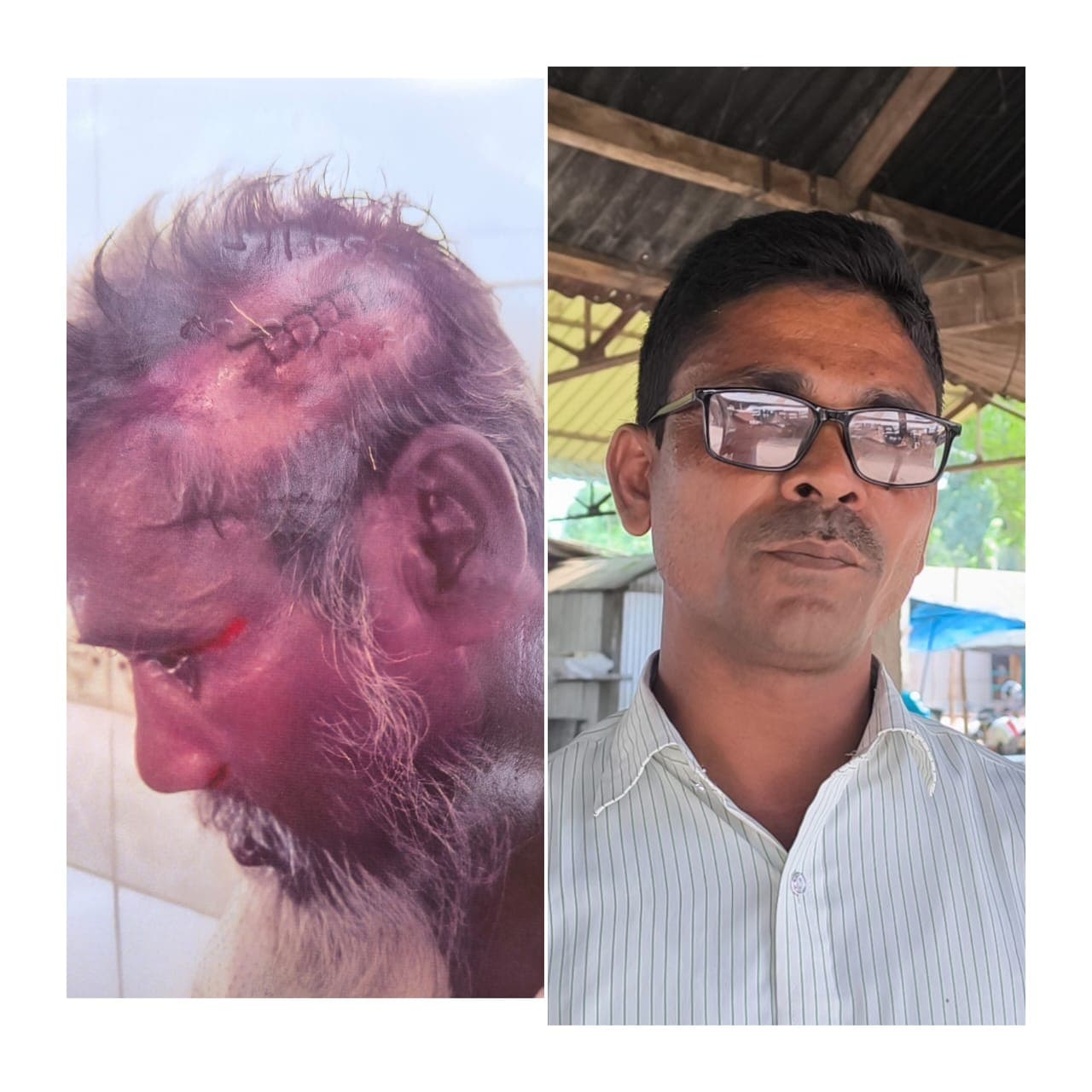 সিরাজগঞ্জে জমি নিয়ে বিরোধ, নিজের মাথা কেটে মামলার নাটক