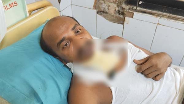 জীবনের ঝুঁকি নিয়ে ৪০ যাত্রীকে বাঁচিয়ে হাসপাতালে বাস চালক