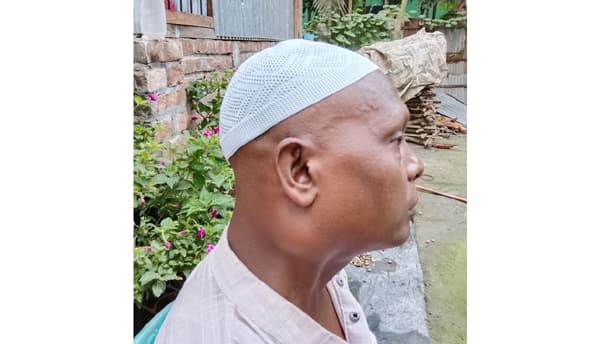 গলায় ক্যানসারে আক্রান্ত চিকিৎসক বাঁচতে চায় সাহায্য