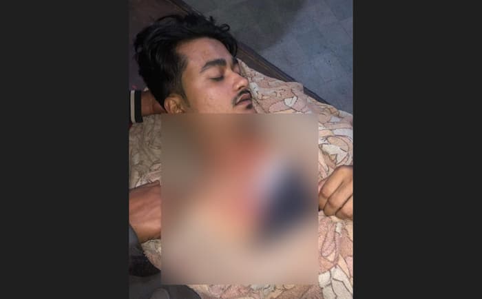 নির্বাচনের ১ মাস আগে চেয়ারম্যান পদপ্রার্থীর উপর সন্ত্রাসী হামলা
