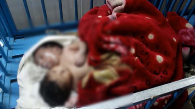 দুই মাথা নিয়ে মাগুরায় শিশুর জন্ম
