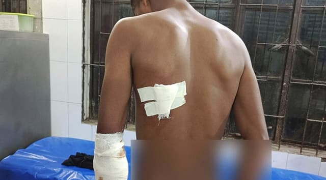 নওগাঁয় মাদকের জেরে যুবককে ছুরিকাঘাত