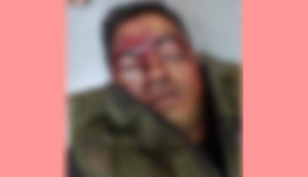 মঠবাড়িয়ায় গৃহ শিক্ষককে কুপিয়ে জখম, আটক দুই