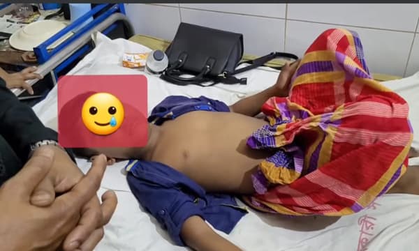 শিশুর খতনায় ভুল, সেই চিকিৎসককে বদলি