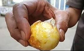 রান্নার সময় হঠাৎ ডিম ‘বিস্ফোরণ’!