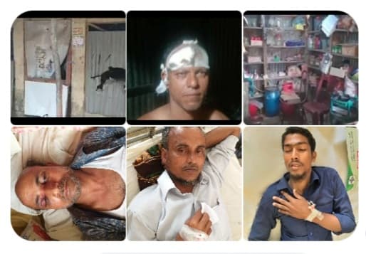 তজুমদ্দিনে নির্বাচনী আধিপত্য বিস্তারের লড়াই আহত, ১৮