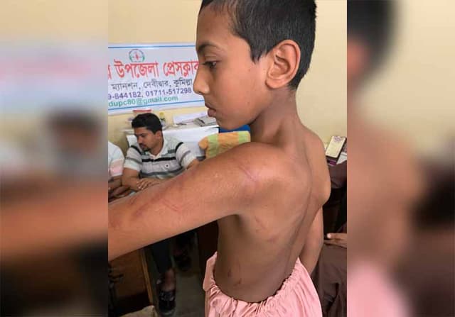 দেবীদ্বারে মাদ্রাসা শিক্ষার্থীকে অমানবিক নির্যাতনের অভিযোগ