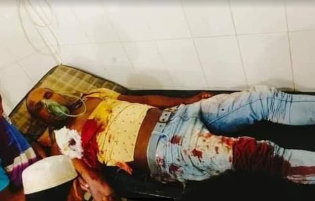 টেকনাফে ডাকাতের গুলিতে নিহত ১