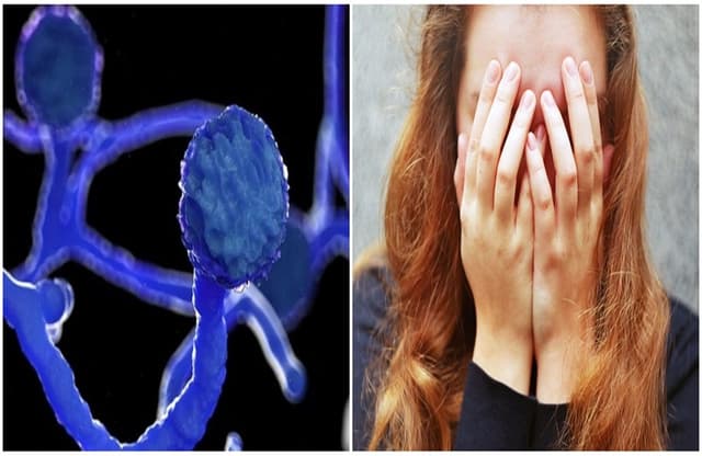 নতুন আতঙ্ক ফাঙ্গাস: লক্ষণ জেনে নিন