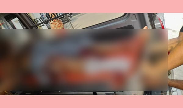 কালকিনিতে বাজার কমিটির সভাপতির পায়ের রগ কর্তন