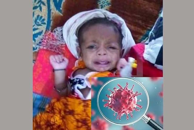 দেশে প্রথম দেড় মাসের শিশুর করোনা শনাক্ত