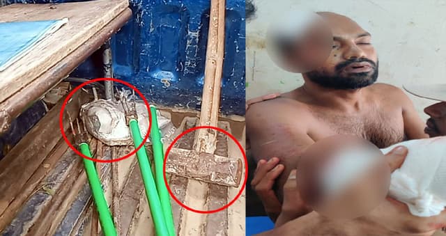 কলাপাড়ায় ছাত্রলীগ নেতার হাতের রগ কর্তন
