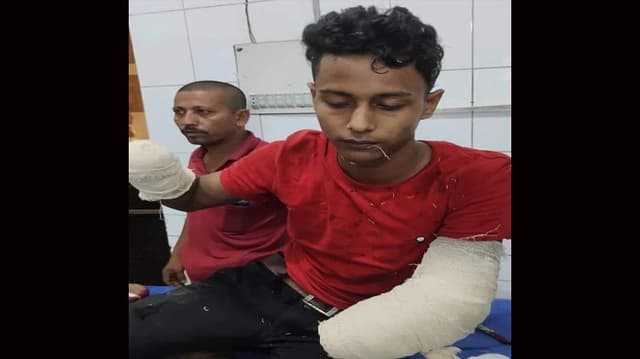 চাচির সাথে পরকীয়া, হাতের কব্জি কেটে নিলো ফুফা