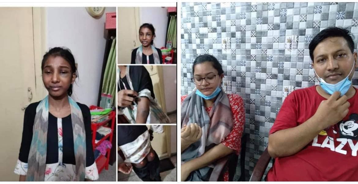 শিশু গৃহকর্মীকে নির্মম নির্যাতন, গ্রেফতার হলো স্বামী-স্ত্রী