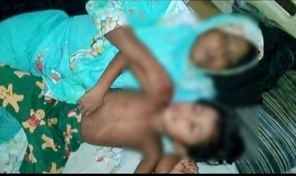 হিজলায় তুচ্ছ ঘটনার দ্বন্দ্বে মা এবং শিশু সন্তান হাসপাতালে