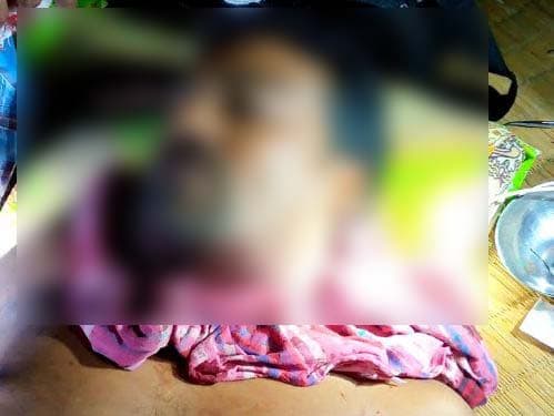 শ্যামনগরে হত্যার উদ্দেশ্যে গলায় ছুরি দিয়ে আঘাত