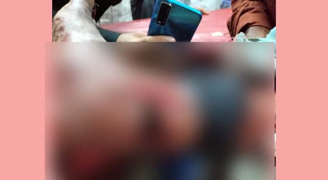 নোয়াখালীতে স্বেচ্ছাসেবক লীগ নেতার পায়ের রগ কাটলেন যুবলীগ কর্মী